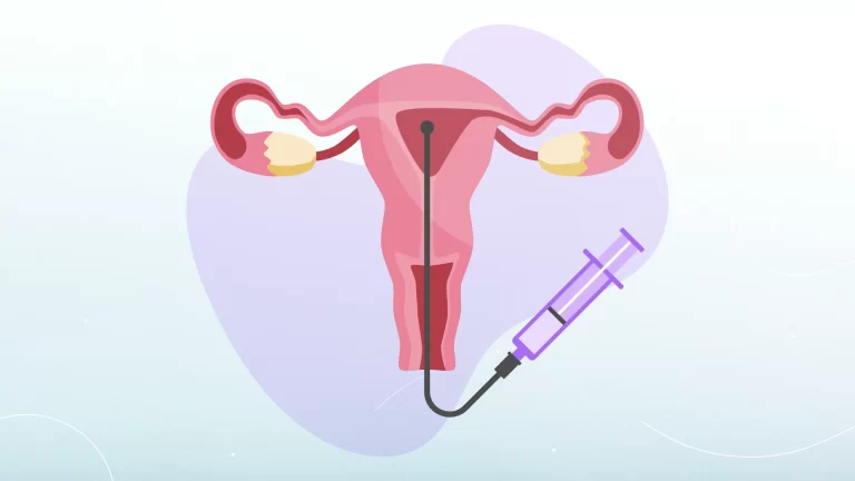 IUI-Symptoms