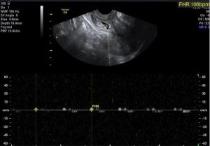 Gynecologist Obstetricians Consultation