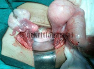 Gynecologist Obstetricians Consultation