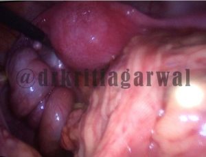 Gynecologist Obstetricians Consultation