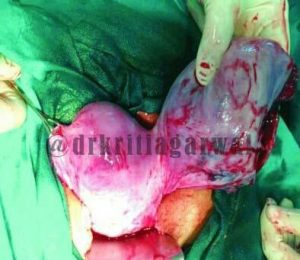 Gynecologist Obstetricians Consultation