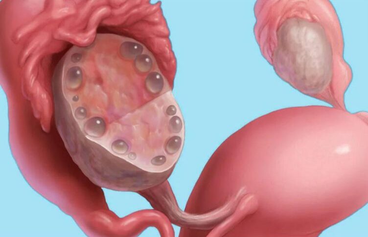 Gynecologist Obstetricians Consultations